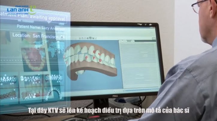 Orthodontic treatment with Invisalign